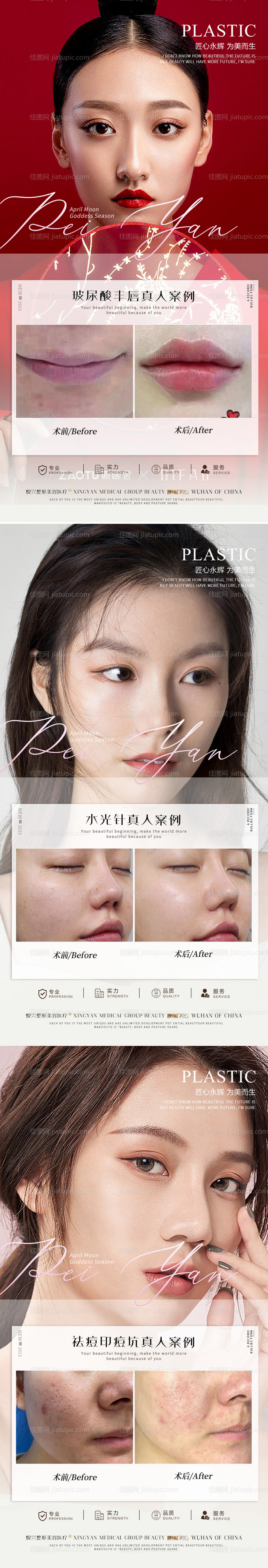 整形真人案例分享集-源文件