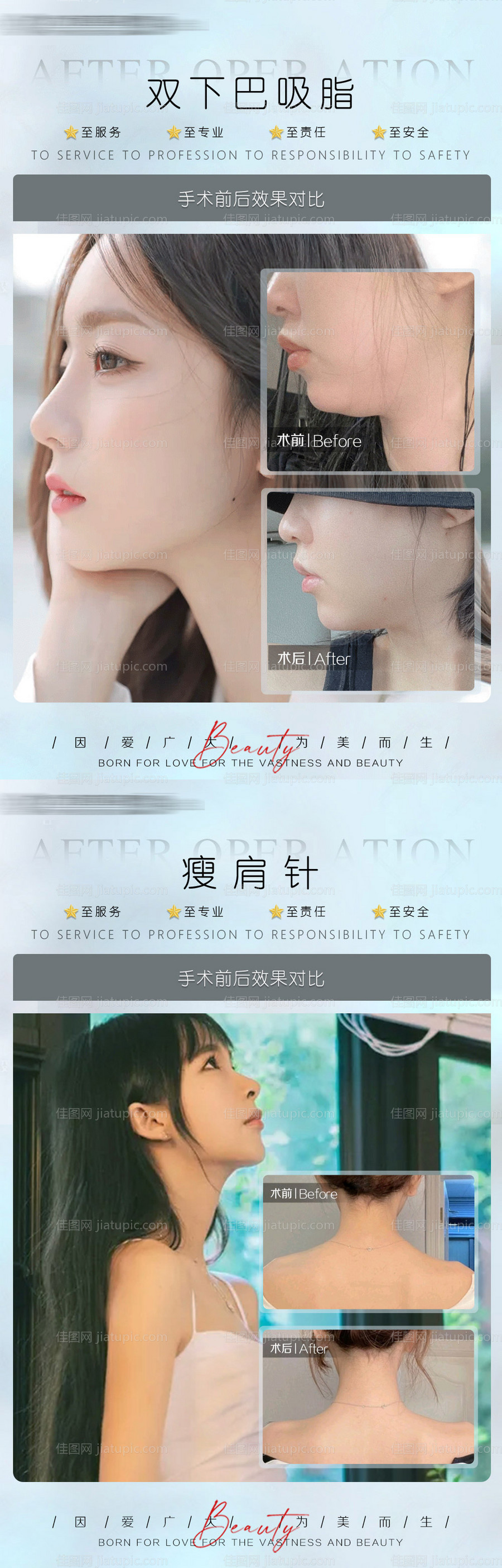 医美真人案例案例对比 -源文件