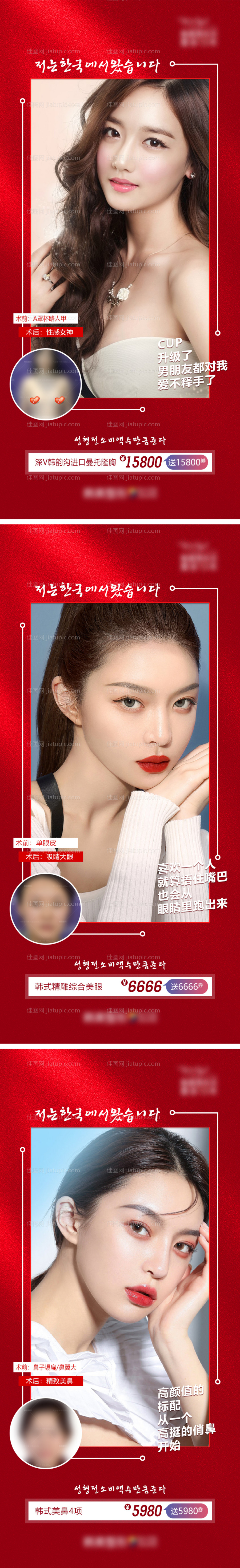 医美整形外科眼鼻胸案例海报-源文件