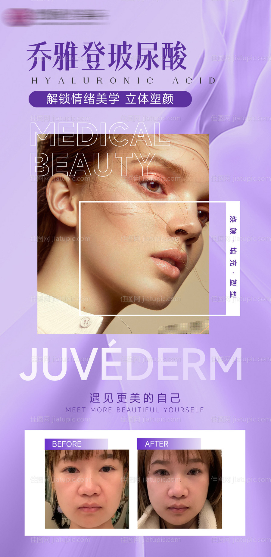 医美乔雅登玻尿酸宣传手机海报-源文件