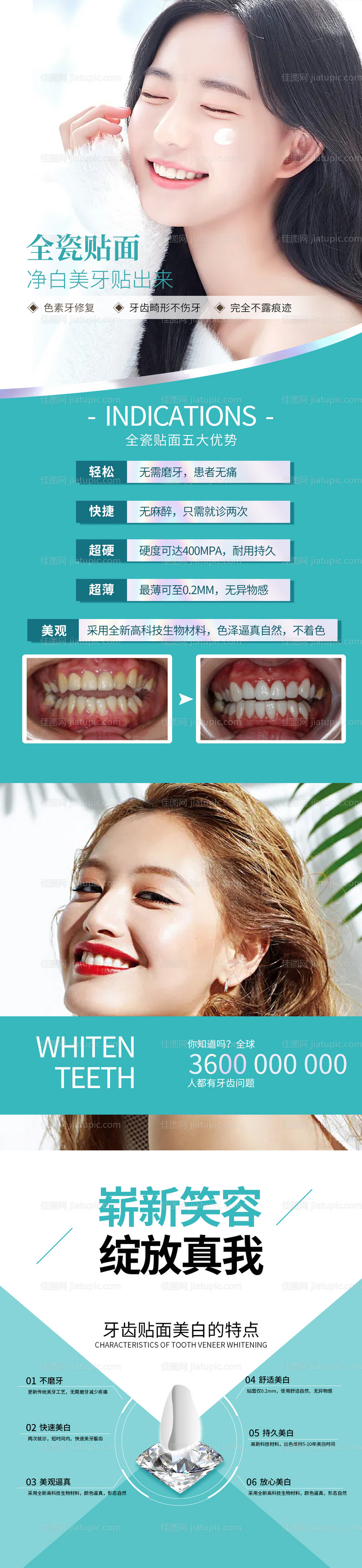 牙齿美白贴面项目海报-源文件