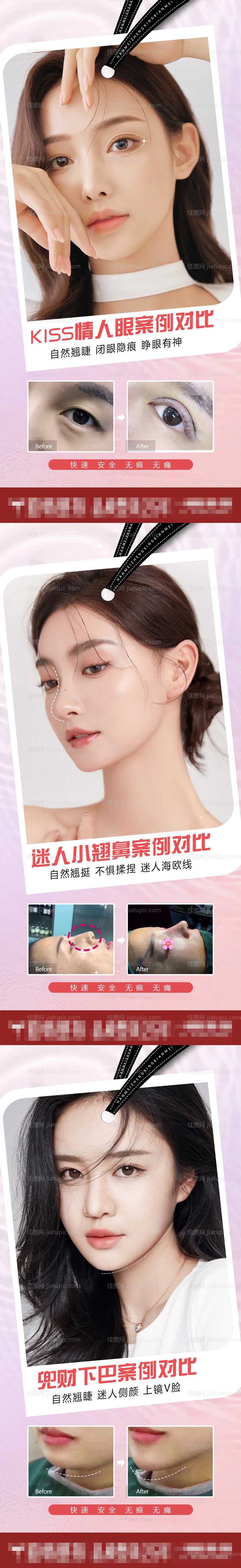 医美整形案例对比海报-源文件