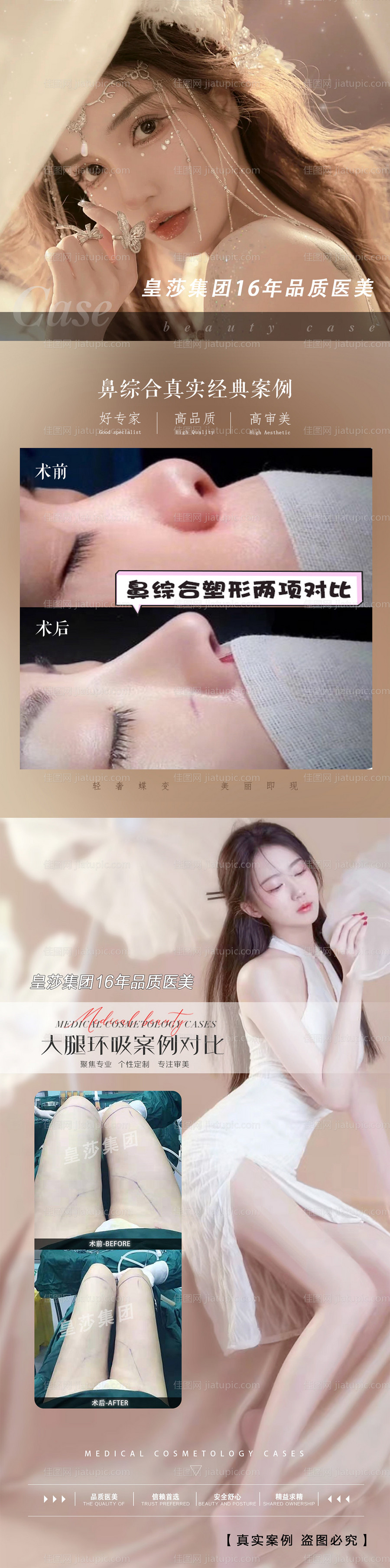 医美案例宣传海报长图-源文件