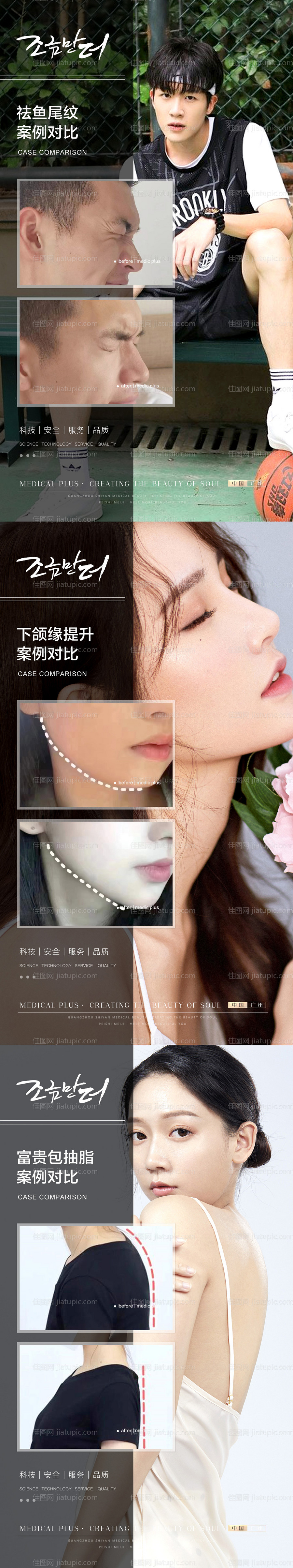 整形真人案例分享集-源文件