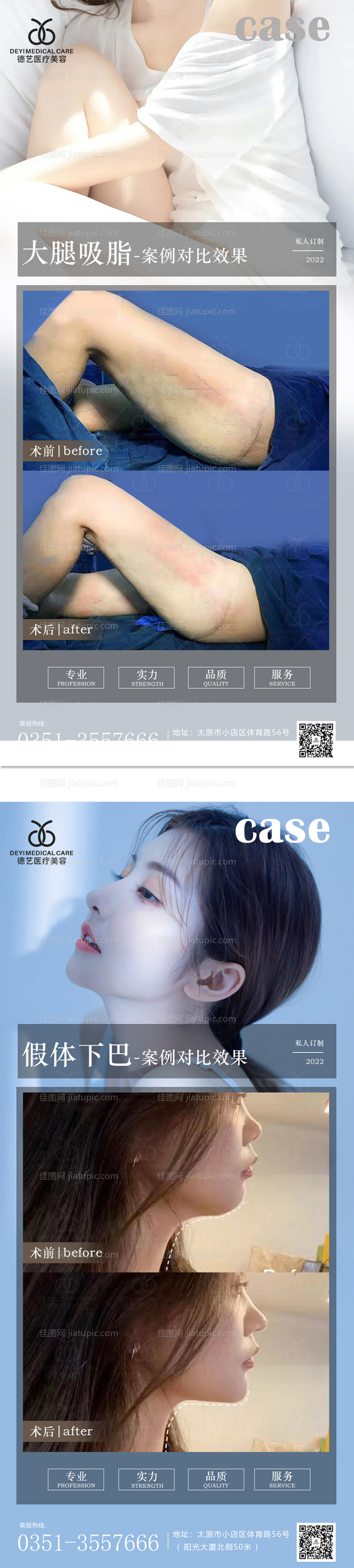 医美案例对比图-源文件