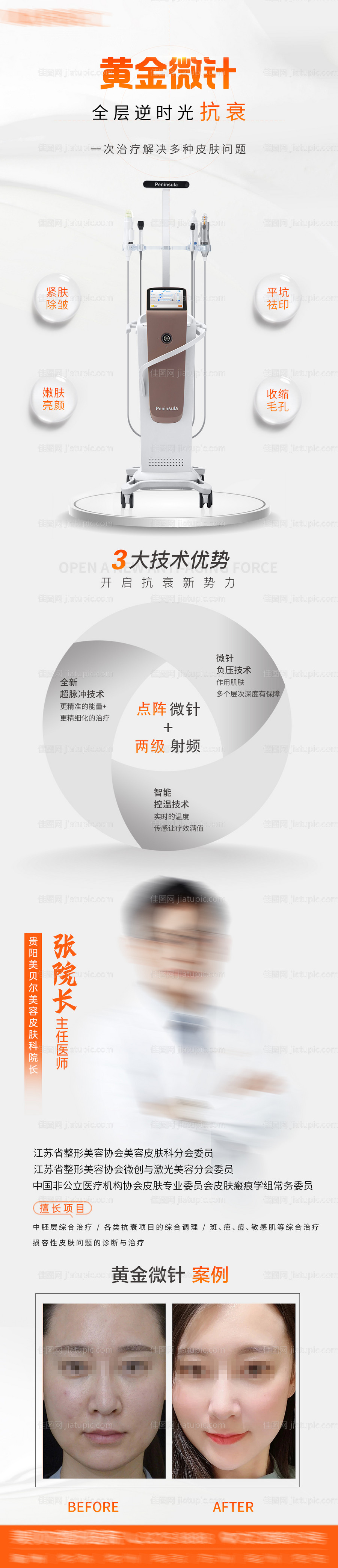 黄金微针详情页-源文件