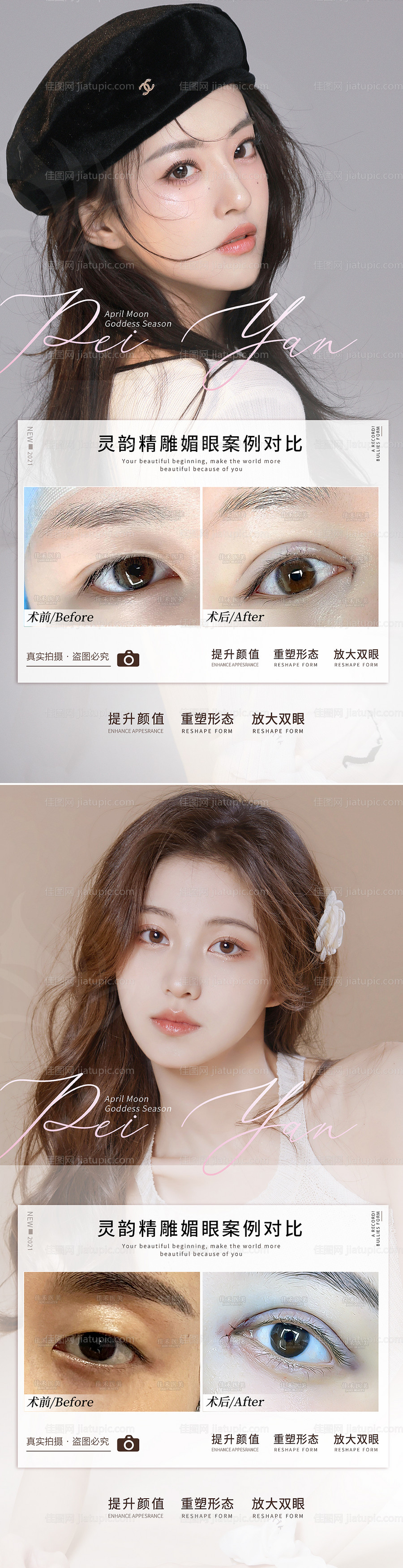 医美双眼皮案例对比海报-源文件