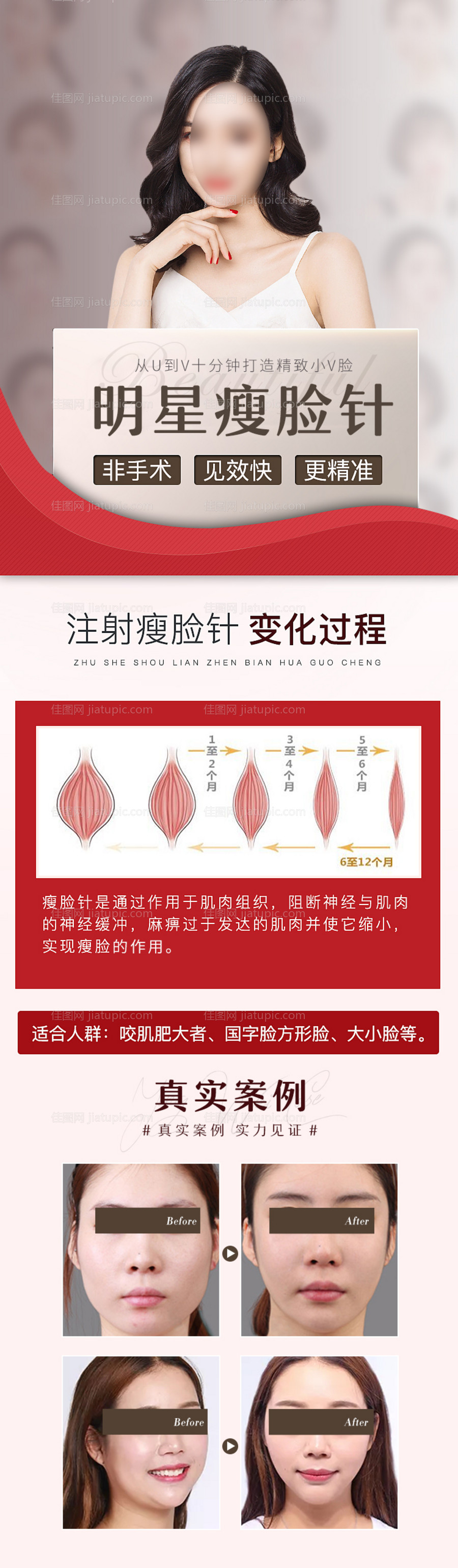 医美整形美容瘦脸针案例对比长图海报-源文件