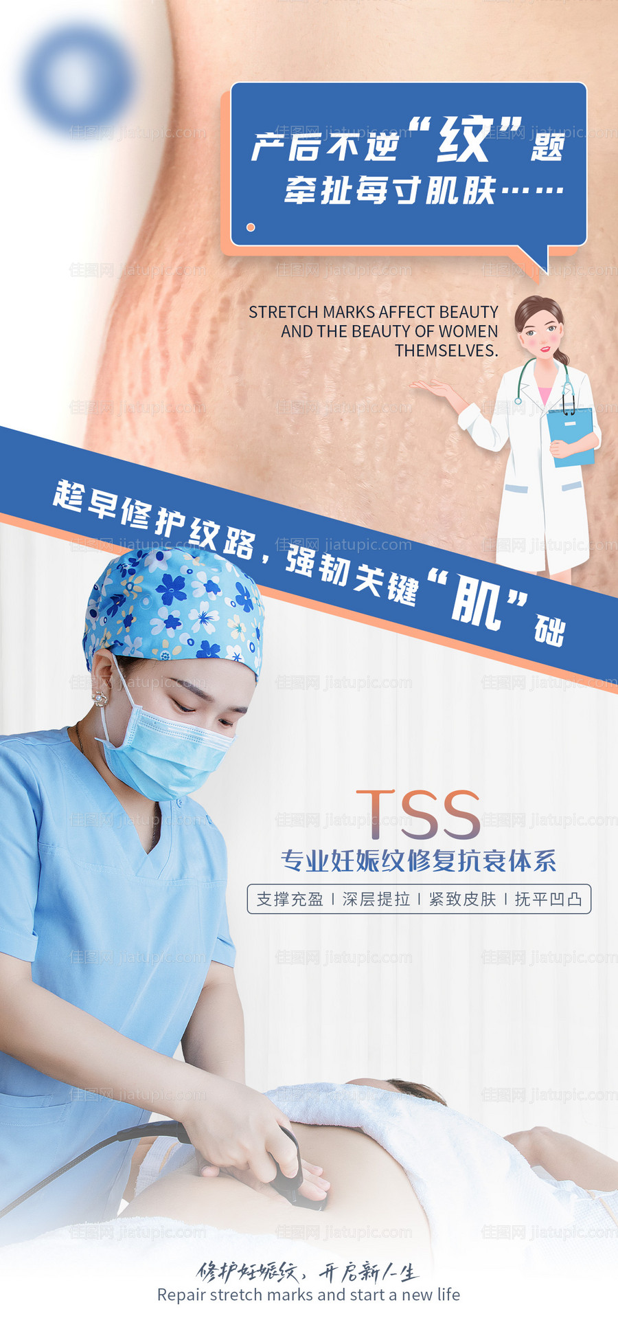 医美妊娠纹修复海报-源文件