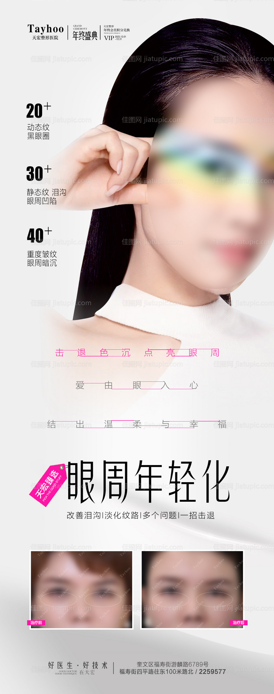 眼周年轻化-源文件