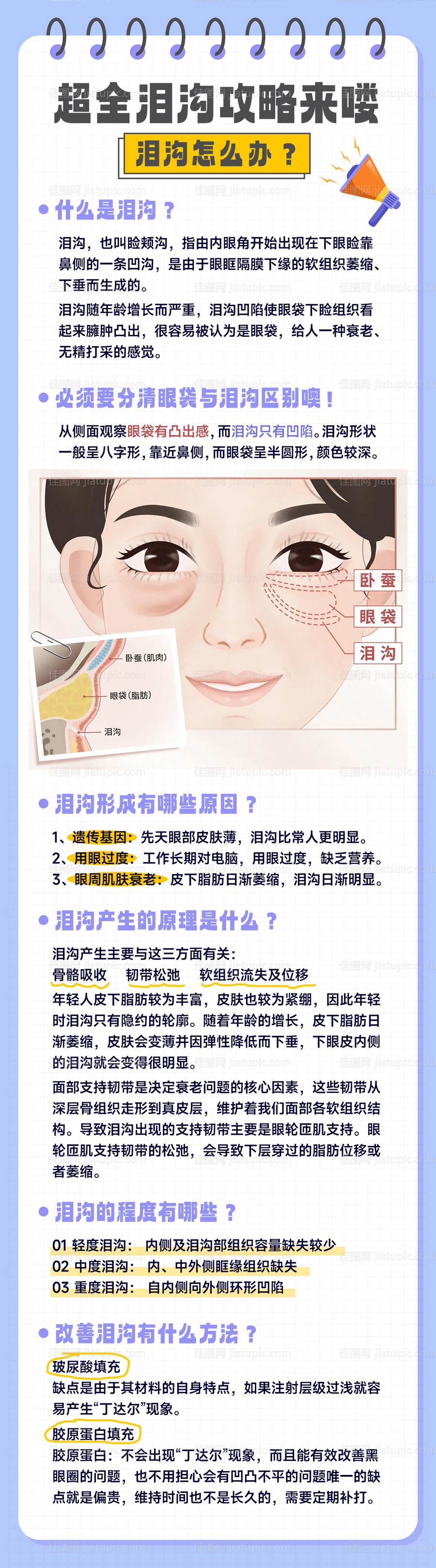 泪沟眼袋眼部医美科普社群海报-源文件