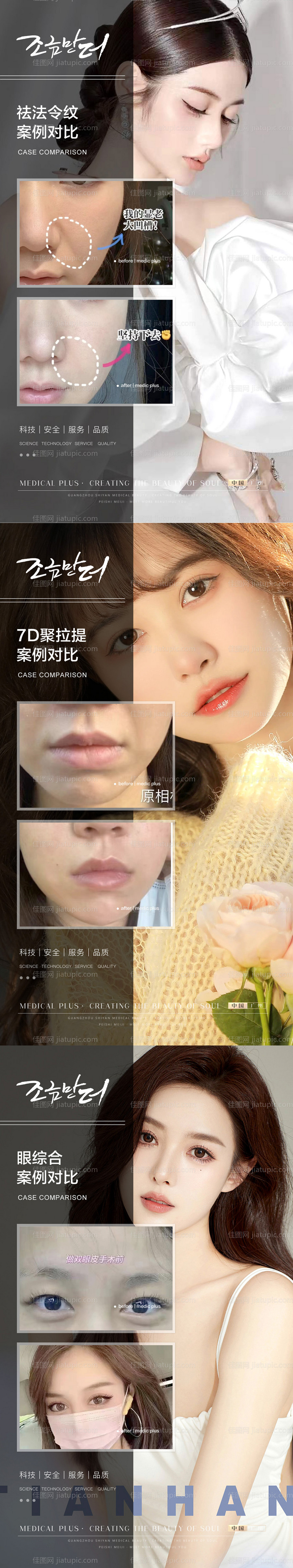 整形真人案例分享集-源文件