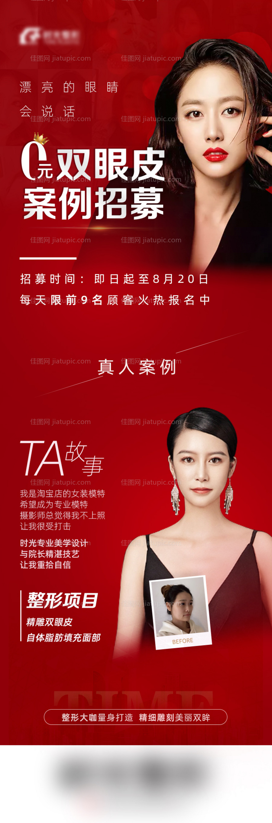 医美双眼皮案例详情页-源文件