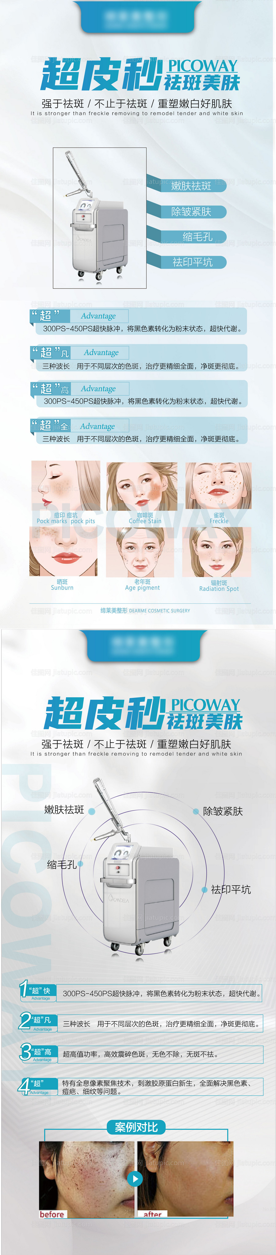 医美超皮秒海报长图-源文件