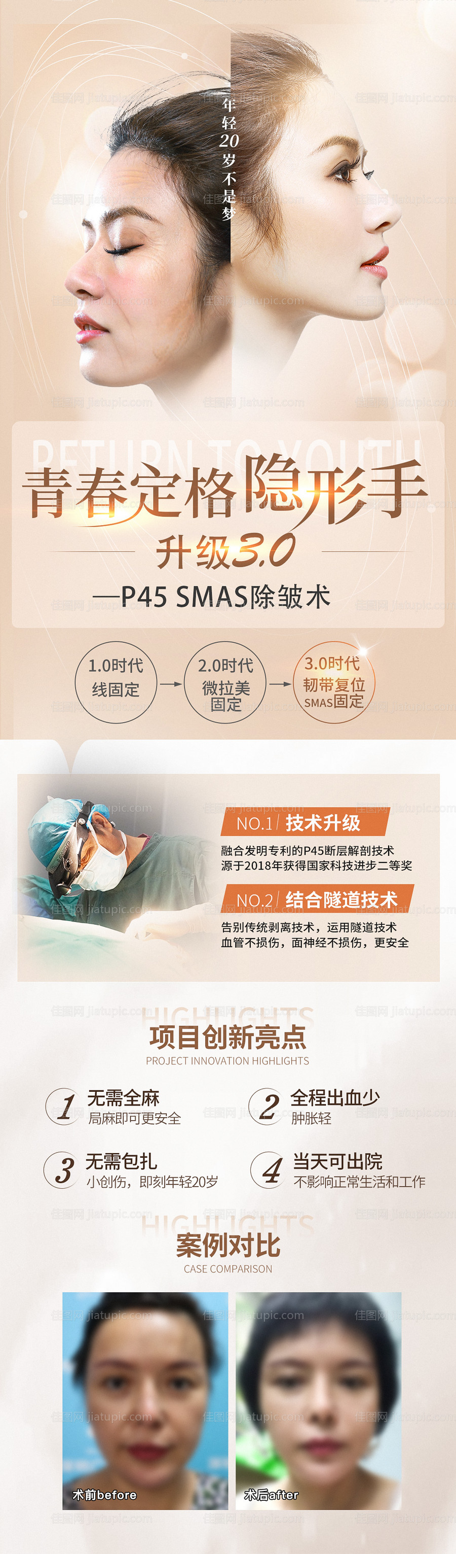 医美抗衰提拉长图-源文件