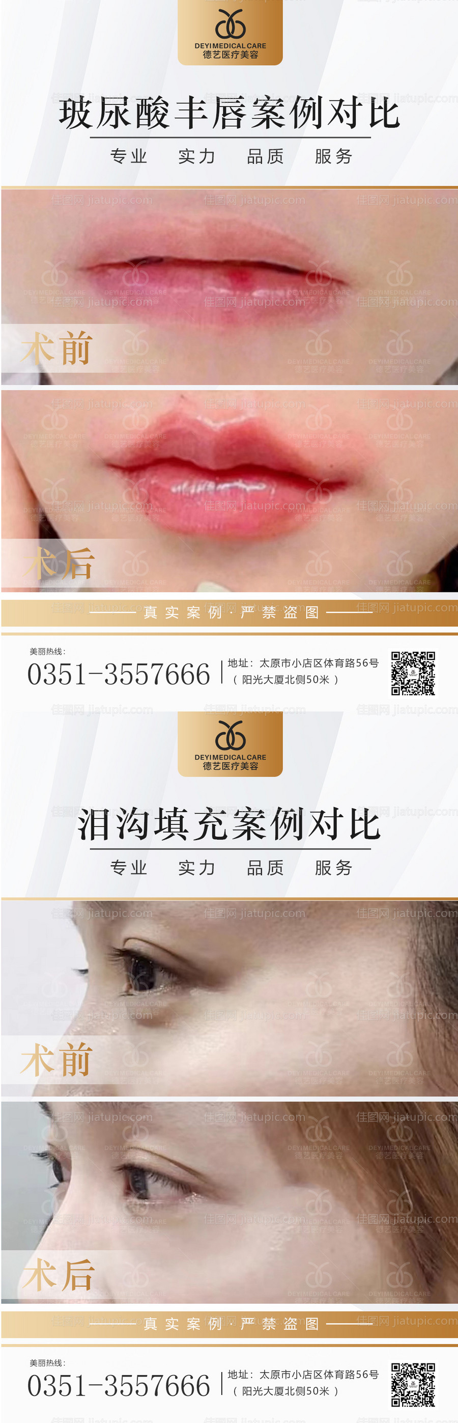 医美案例对比图-源文件