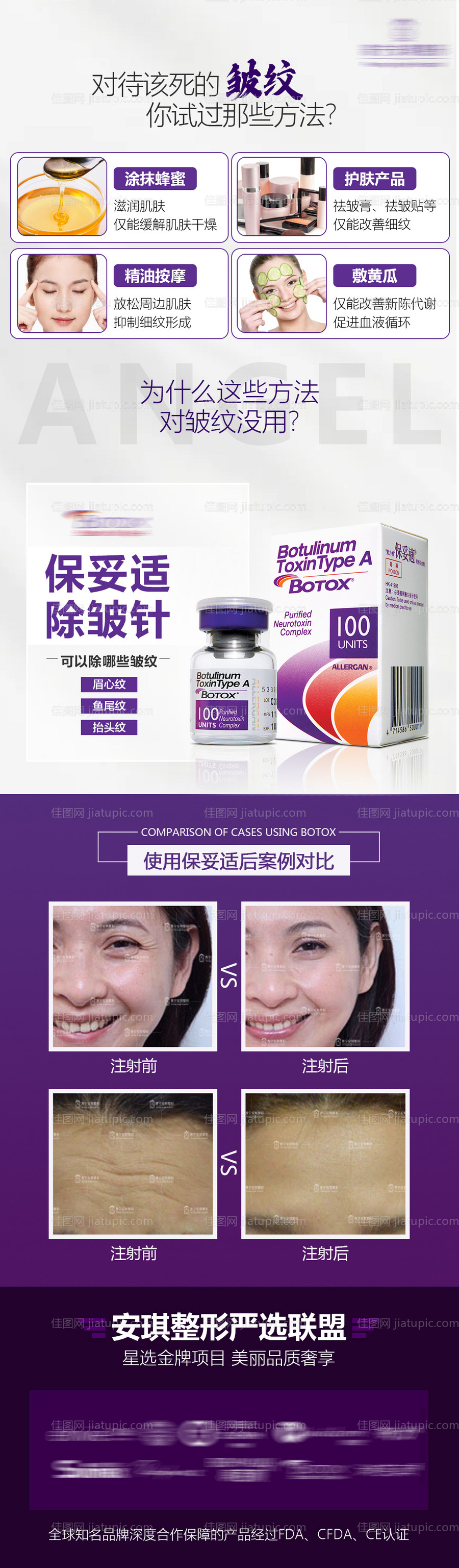 保妥适除皱针整形海报-源文件