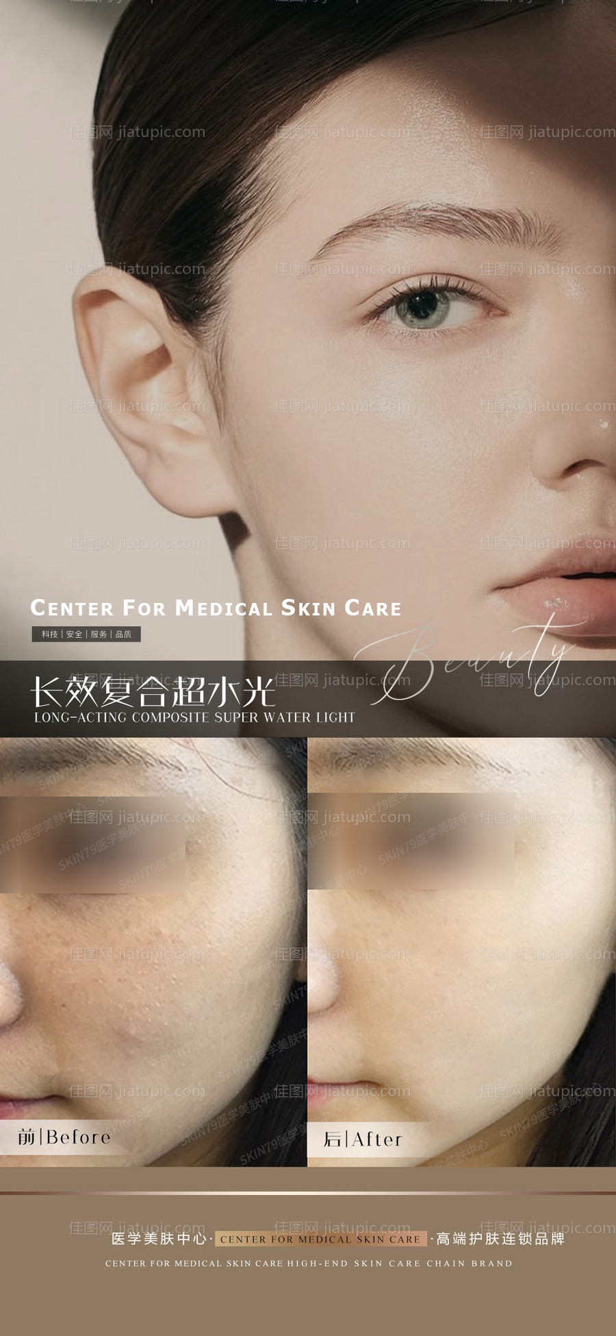 医美水光针科普宣传海报-源文件