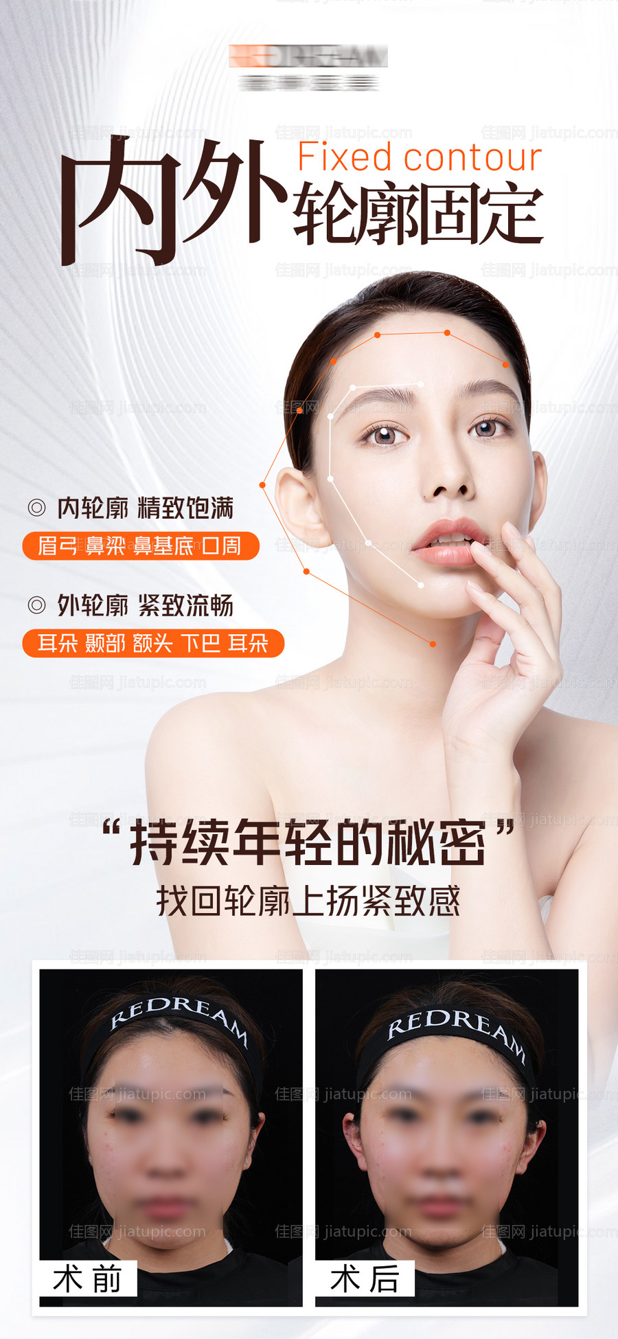 医美内外轮廓固定-源文件