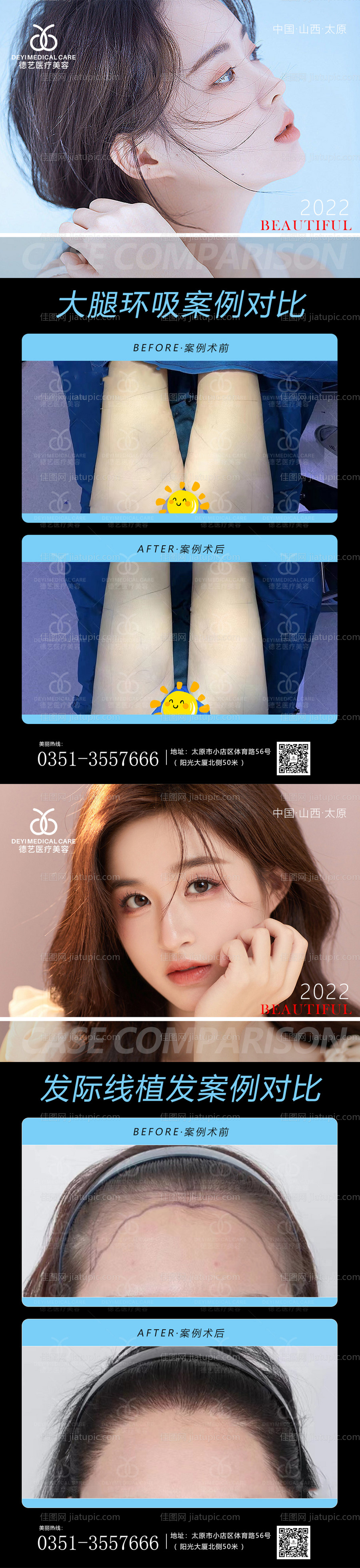 医美案例对比图-源文件