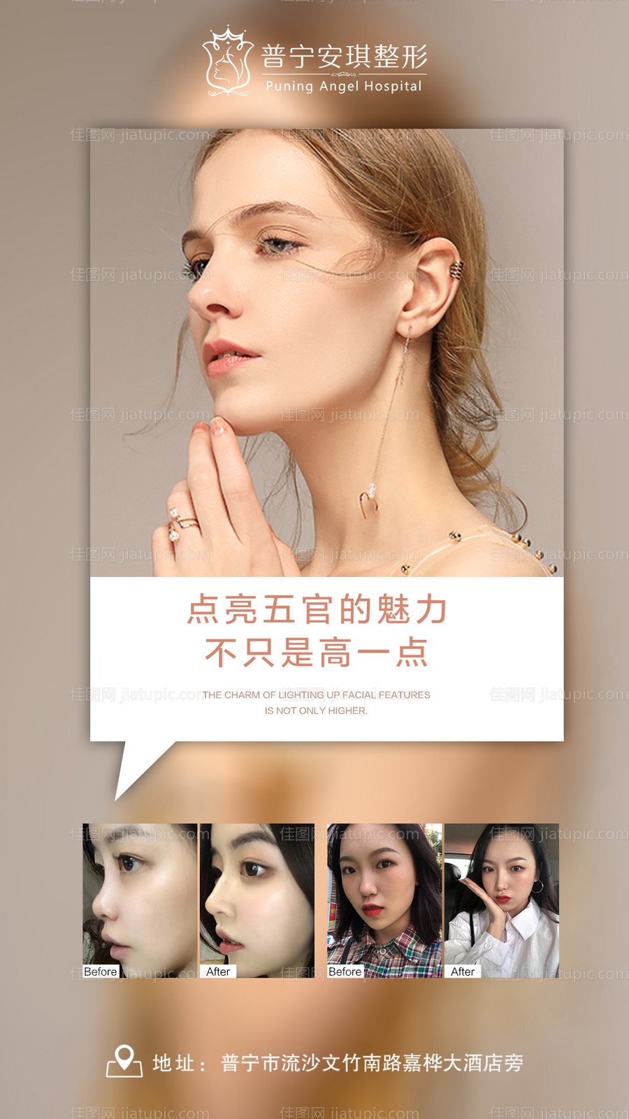 医美隆鼻整形对比海报-源文件