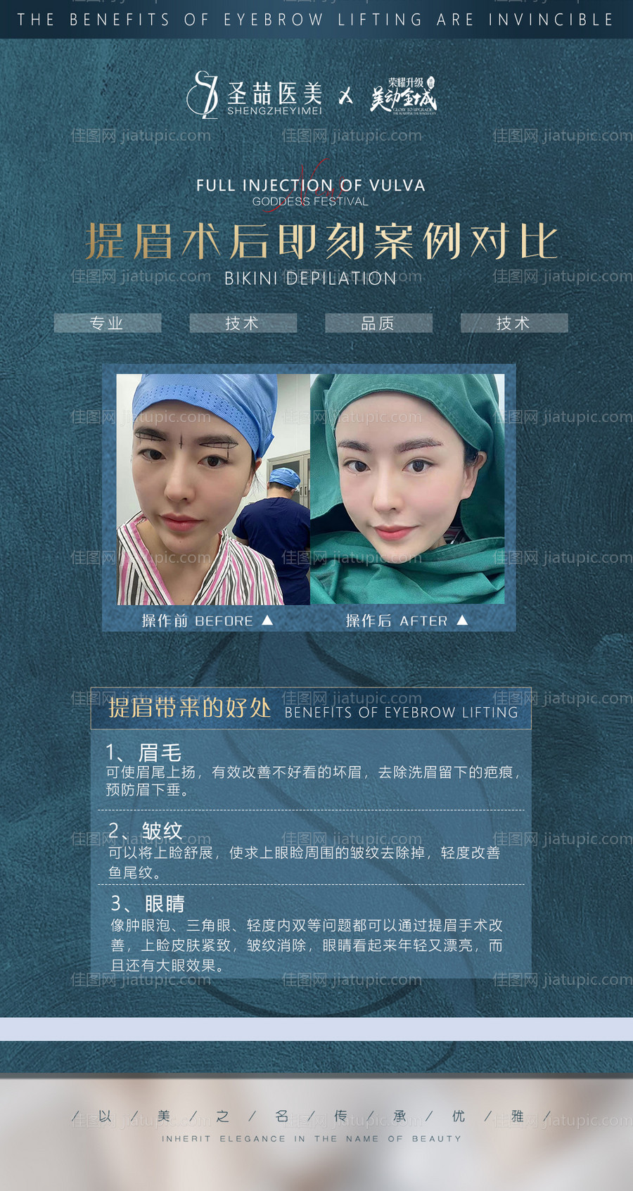 医美整形案例-源文件