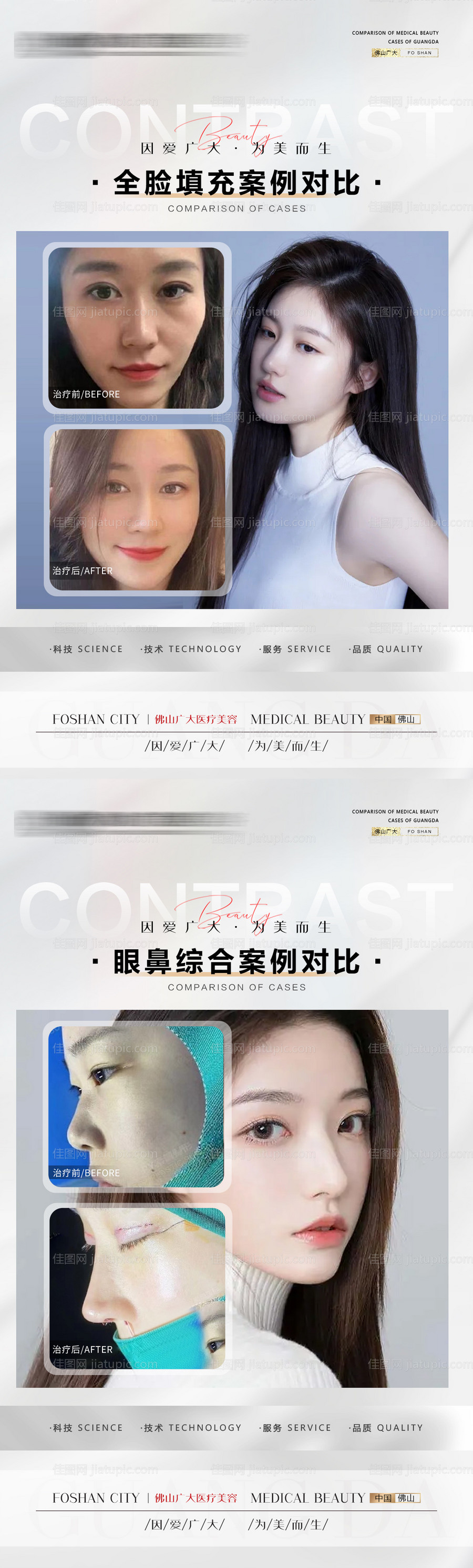 整形真人案例分享集-源文件