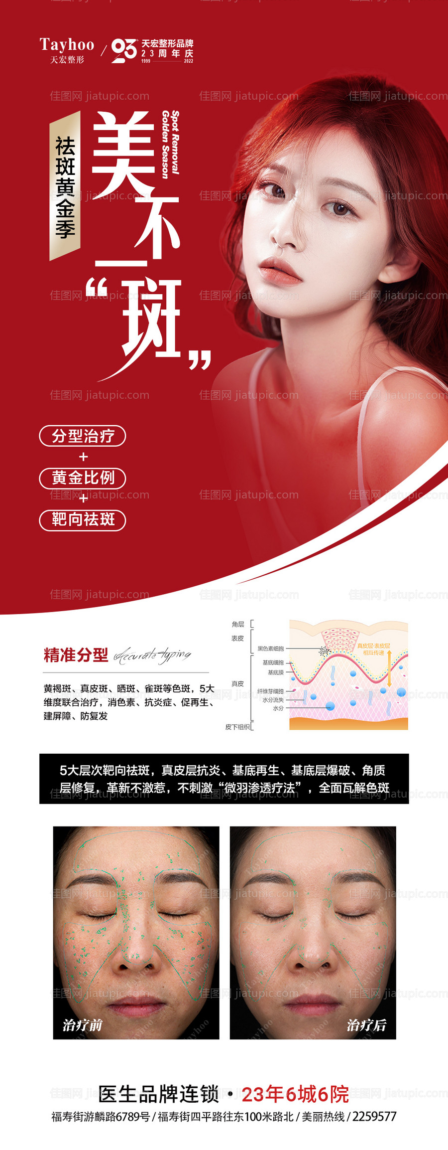 医美整形海报祛斑黄金季案例对比-源文件
