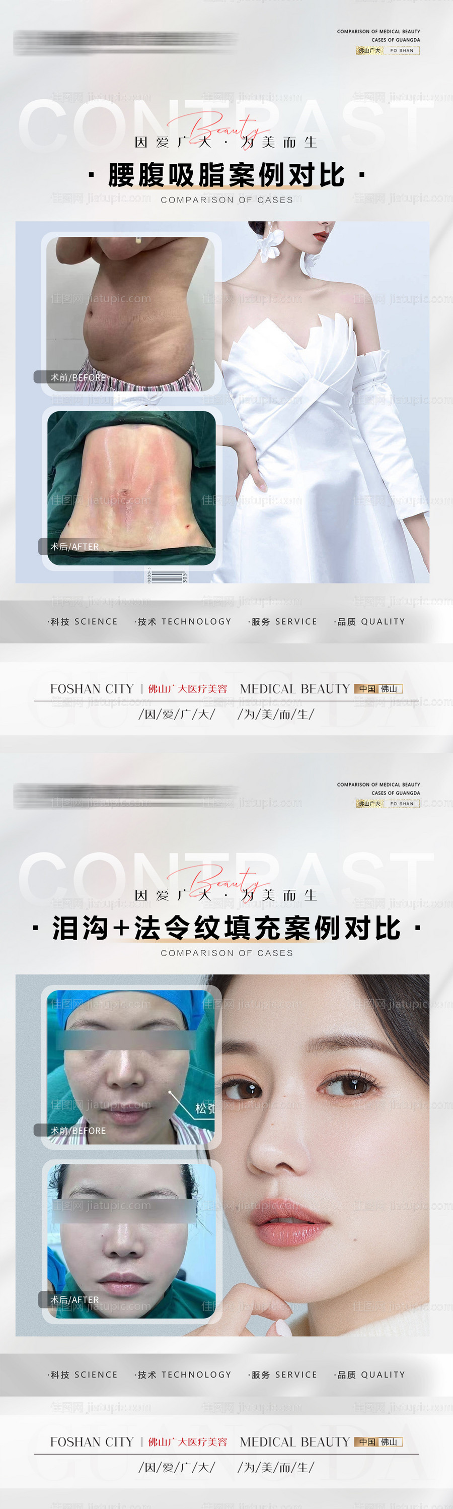 整形案例-源文件