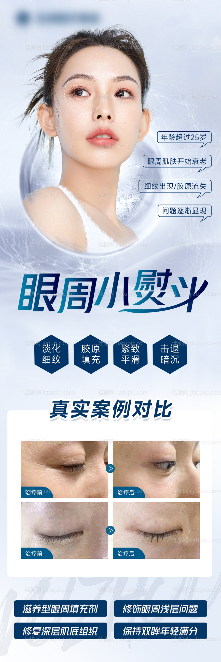 眼周小熨斗海报长图-源文件