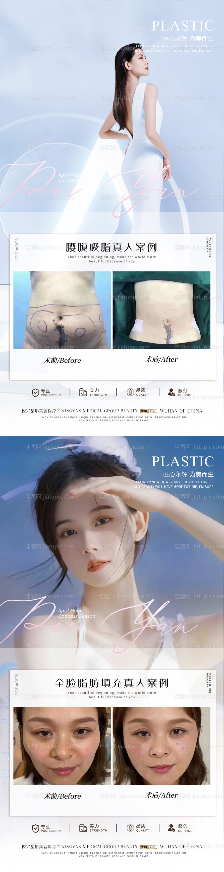 整形真人案例分享集-源文件