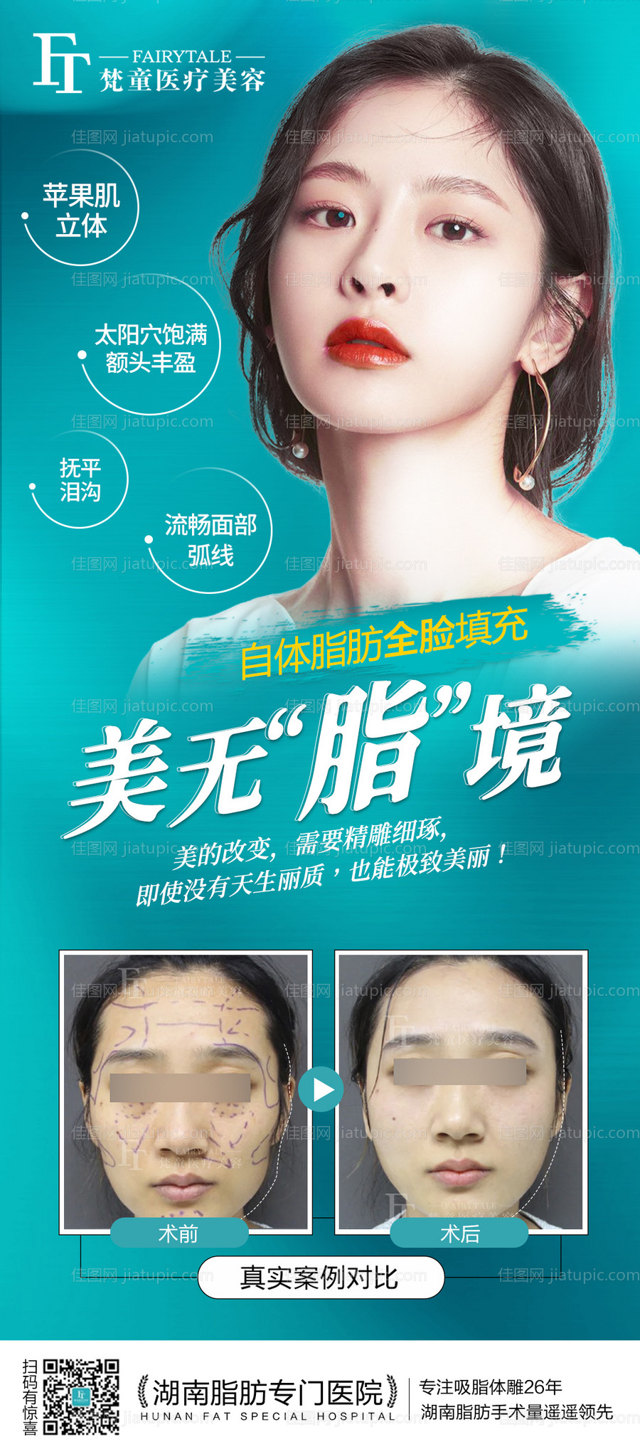 脂肪填充海报-源文件