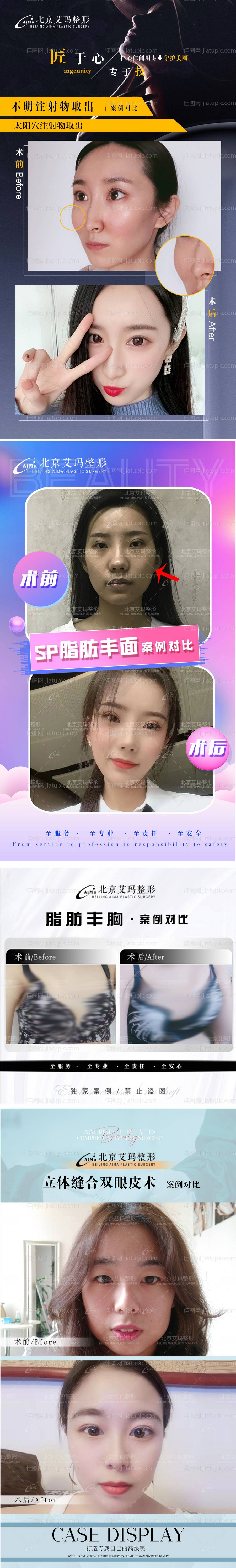 医美案例对比系列海报-源文件