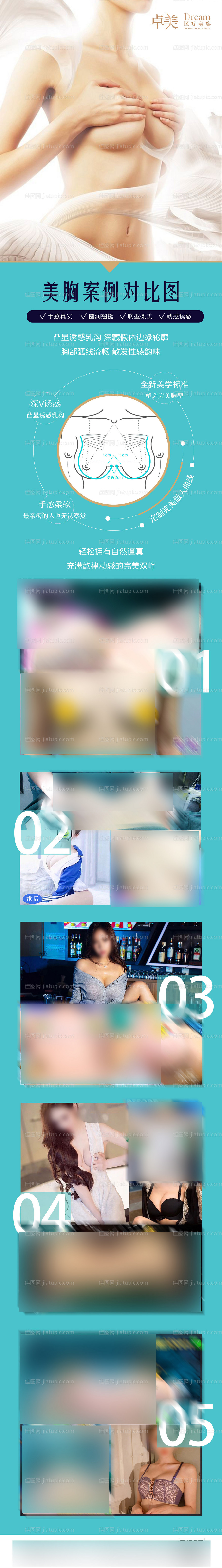 医美整形胸部案例对比图-源文件