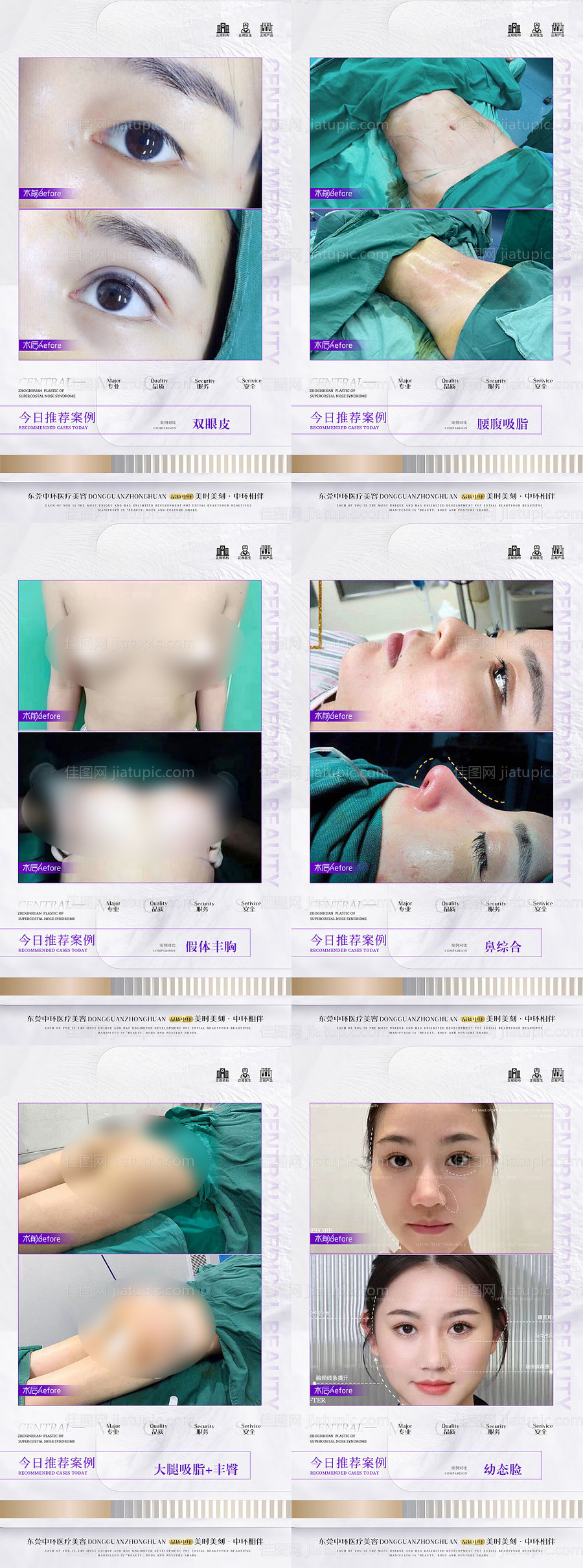 医美案例集合-源文件