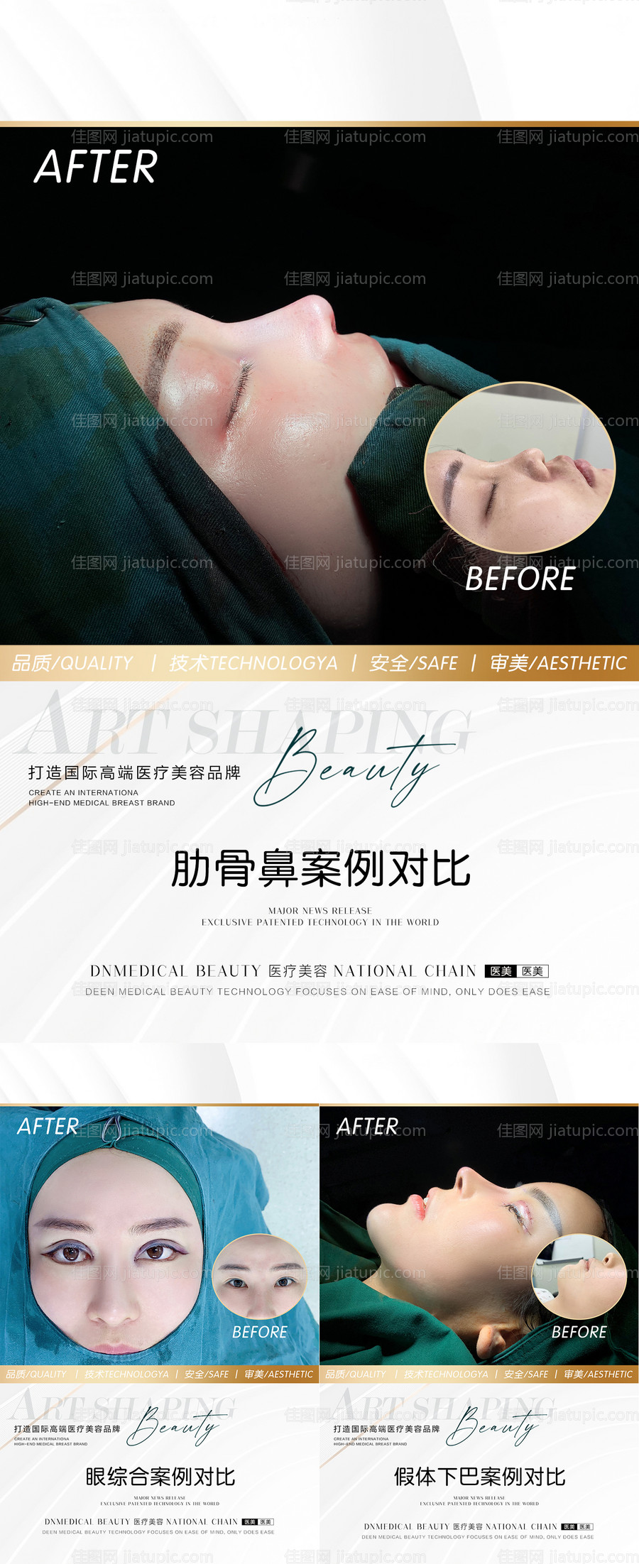 医美整形案例长图海报-源文件