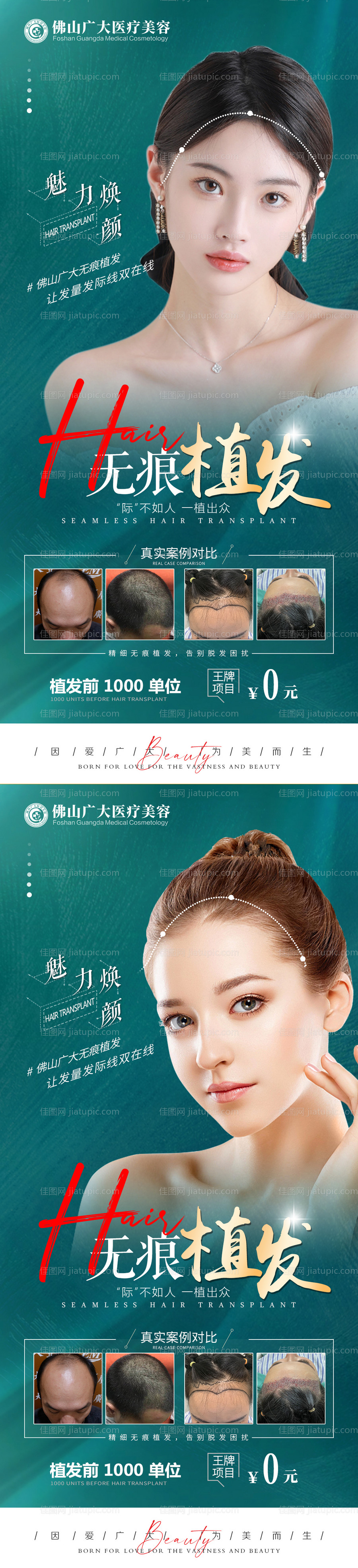 植发活动案例长图海报-源文件