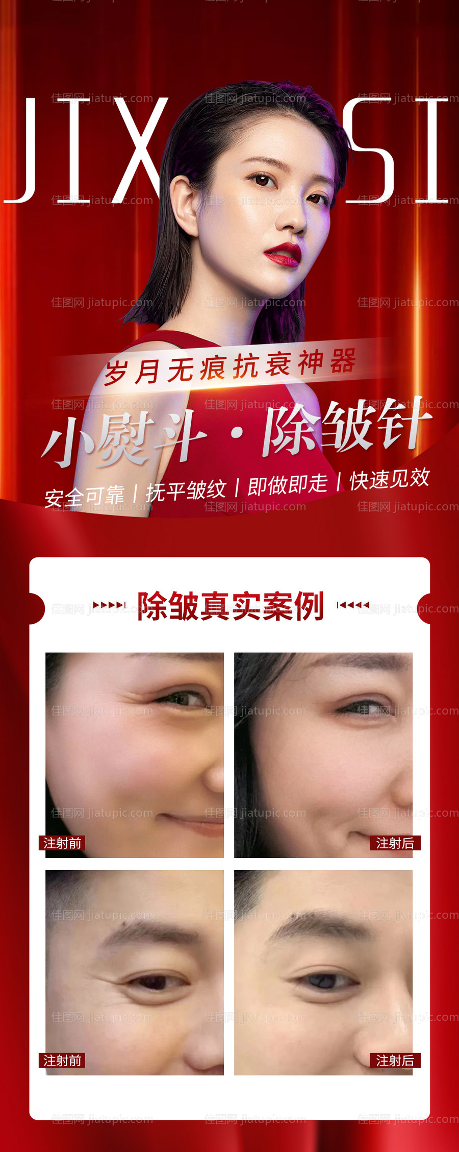 医美整形美容除皱对比案例海报瘦脸-源文件