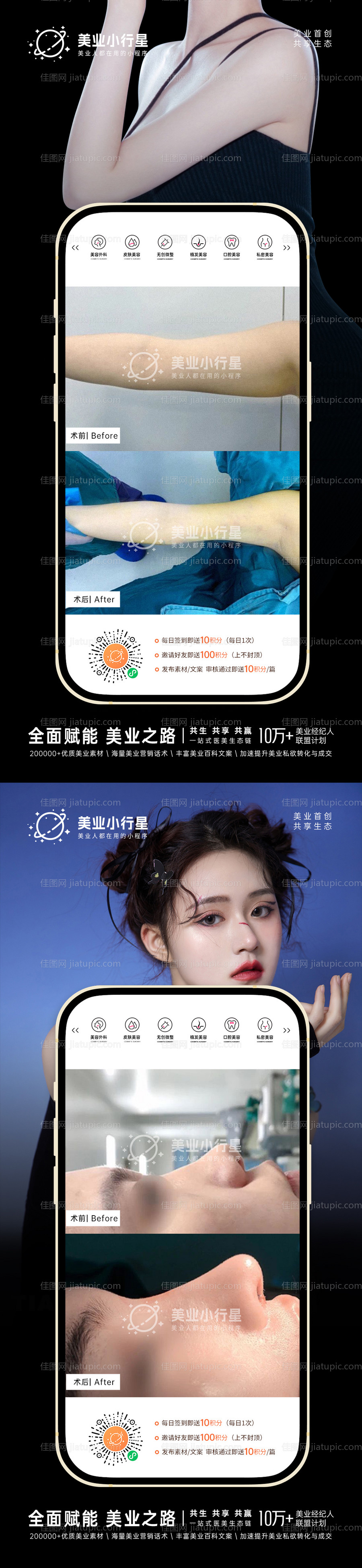 整形真人案例分享集-源文件