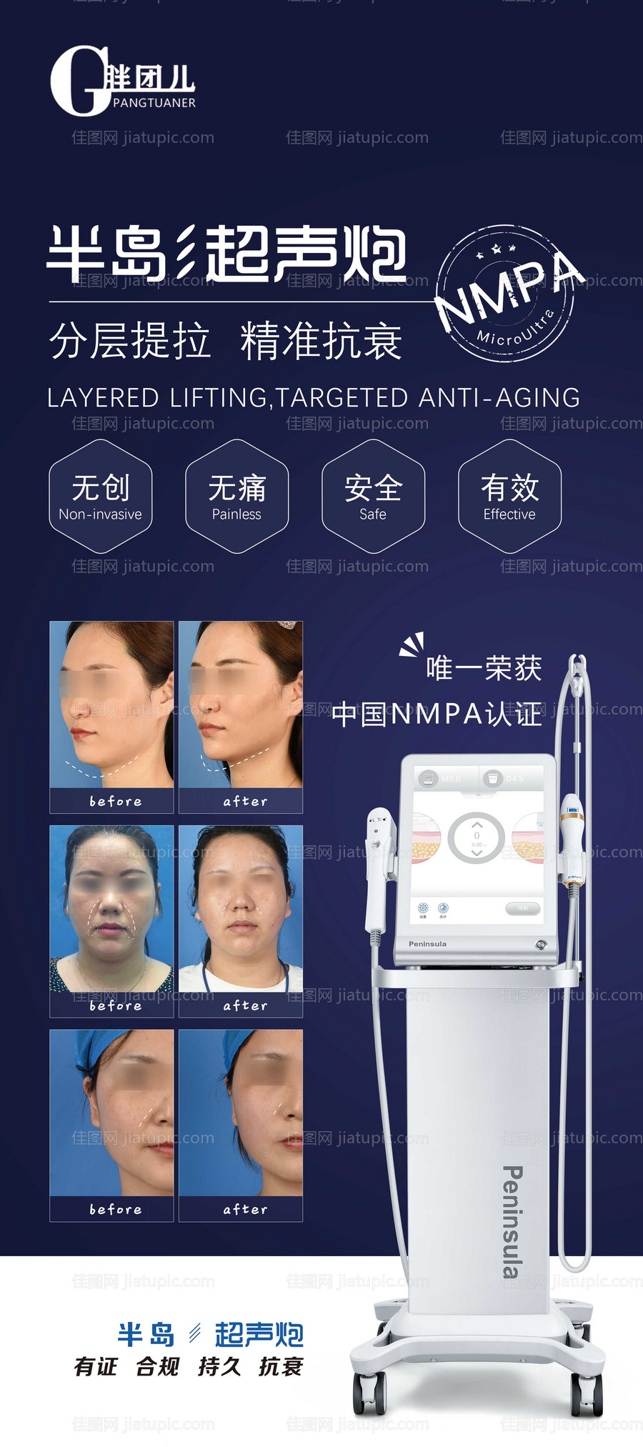 医美超声炮展架易拉宝-源文件