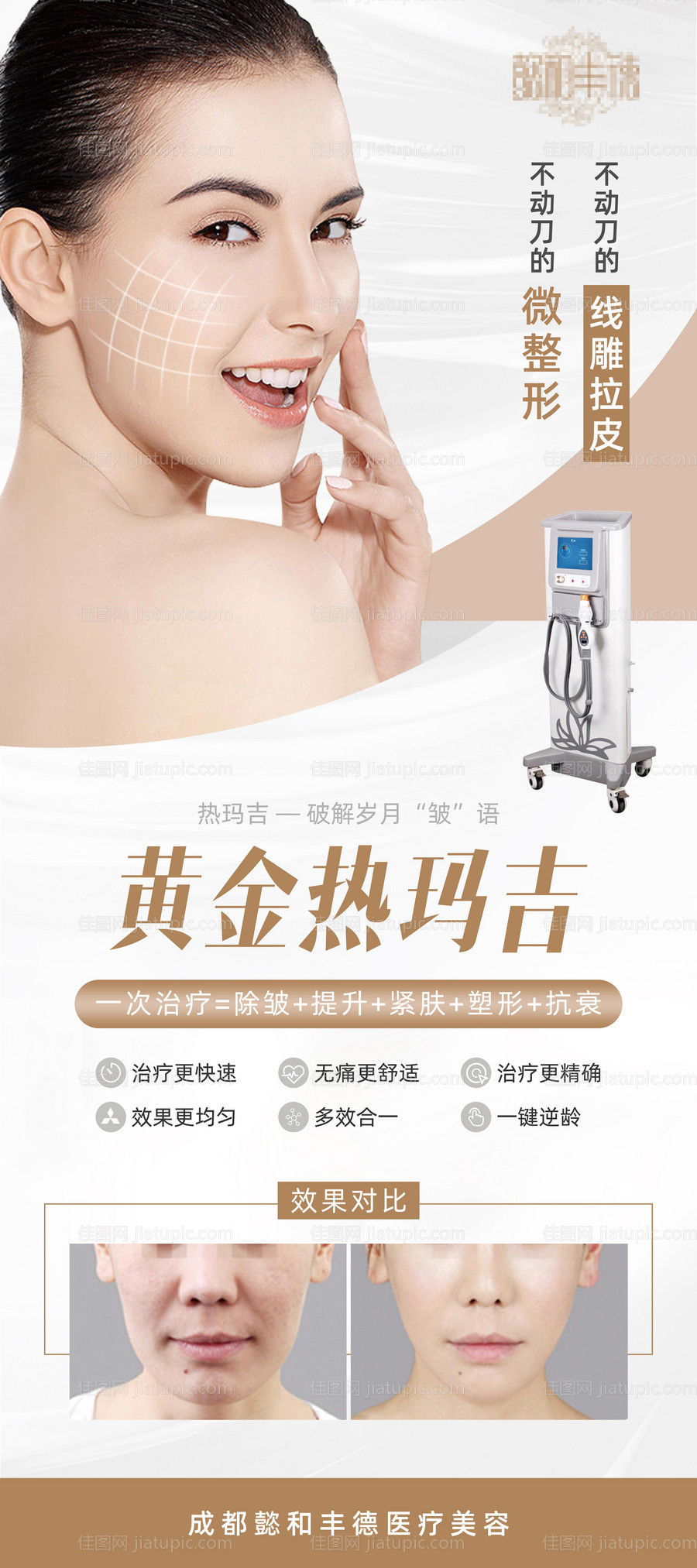 医美热玛吉介绍展架易拉宝-源文件