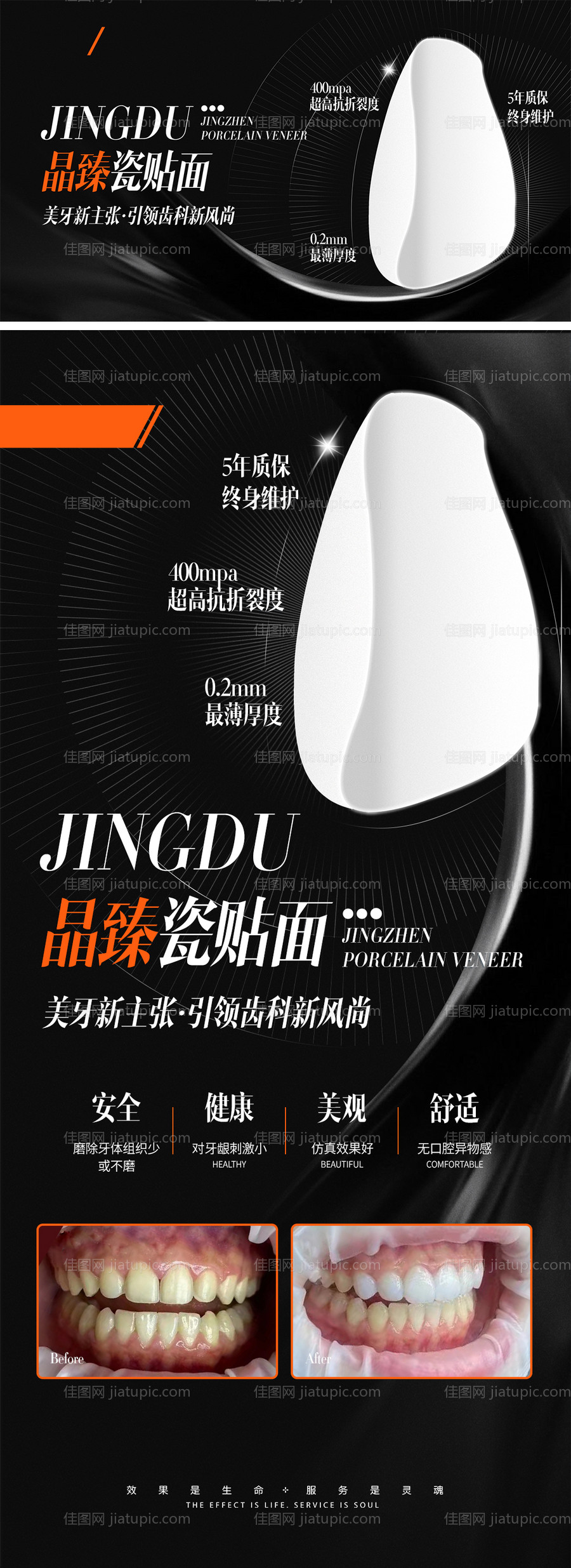 医美牙科贴面海报-源文件