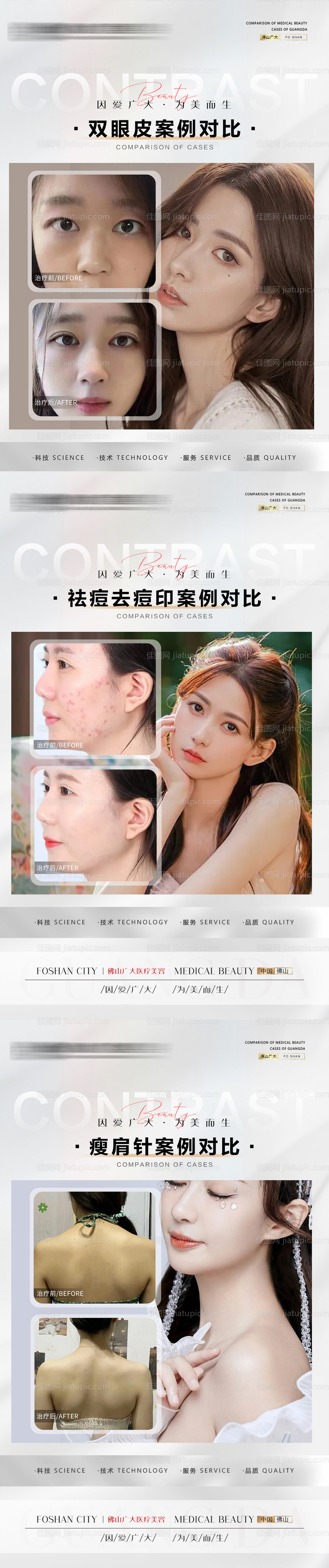 整形真人案例分享集-源文件