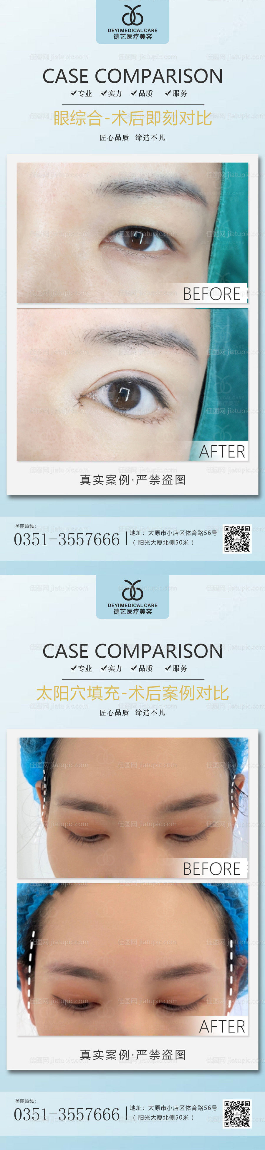 医美案例对比图-源文件