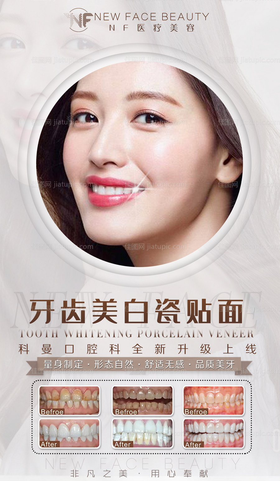 整形口腔牙齿美白海报-源文件