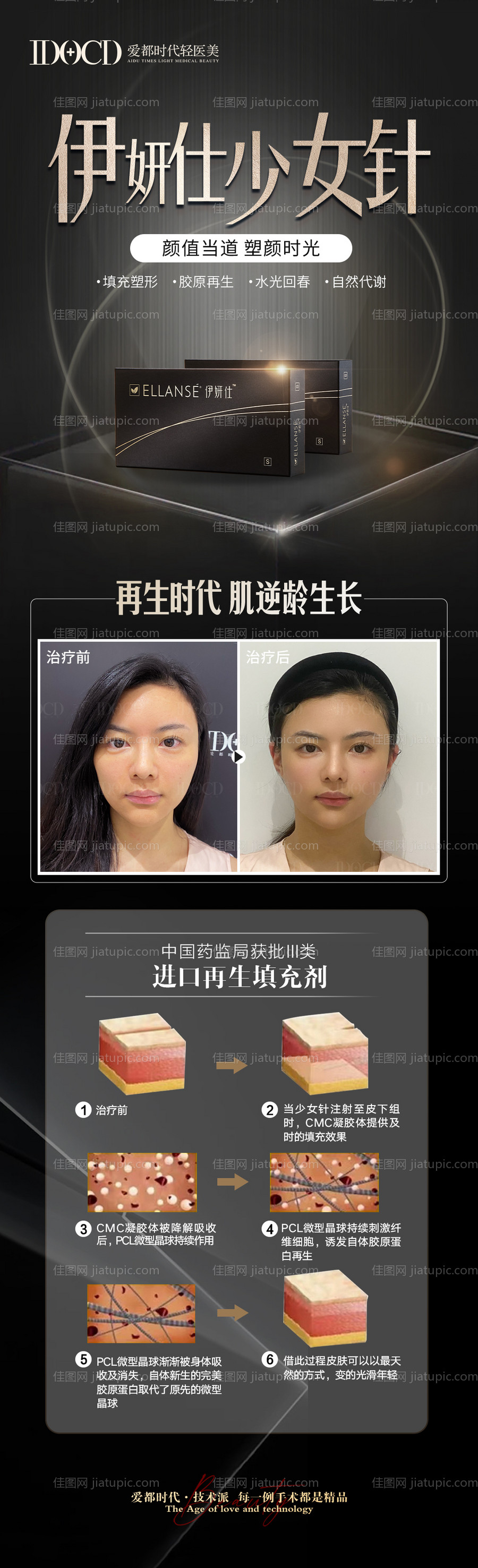 医美伊妍仕少女针案例长图海报-源文件