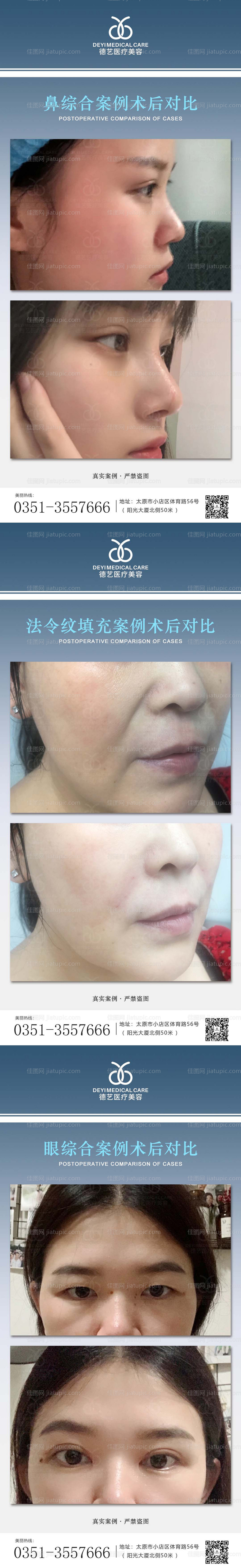 医美案例对比图-源文件