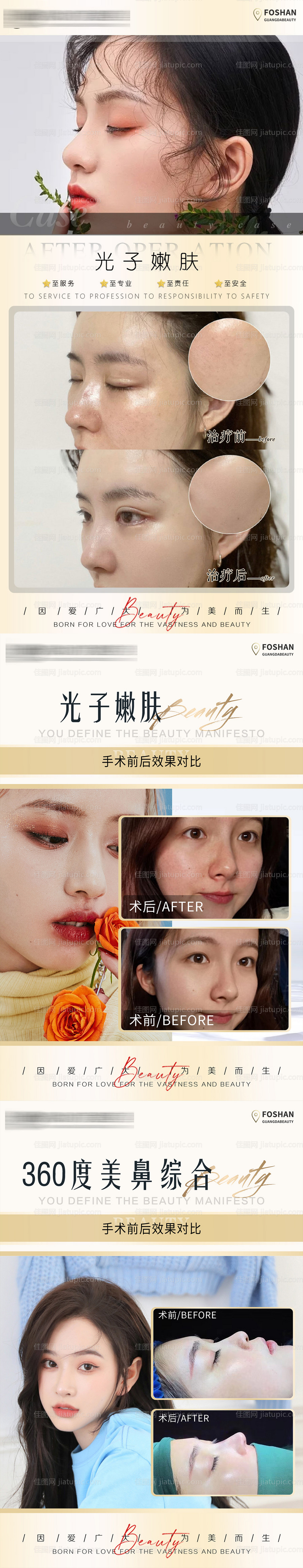 整形真人案例分享集-源文件