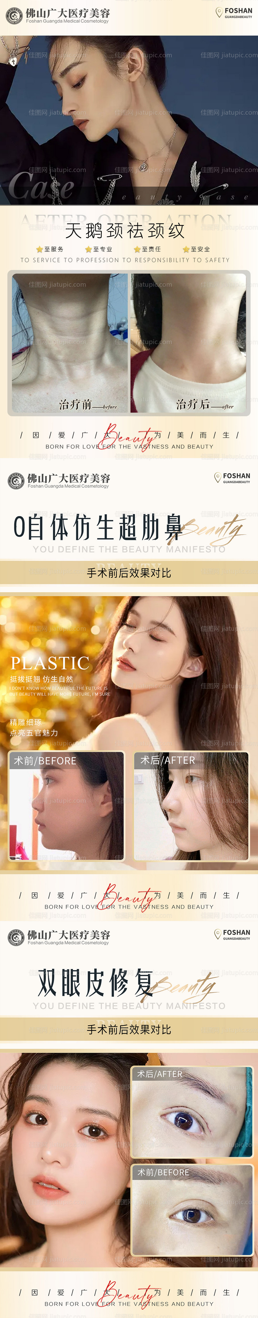 整形真人案例分享集系列海报-源文件