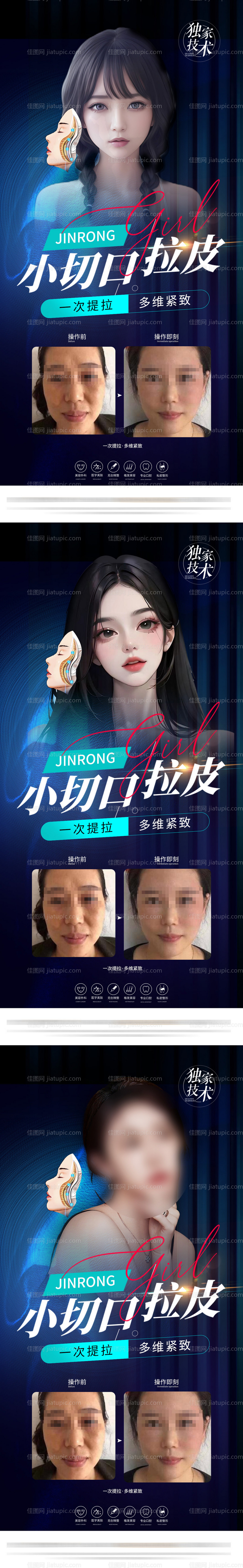 医美小切口拉皮海报-源文件